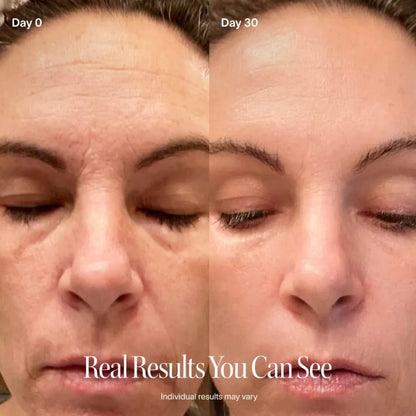 Red Light Therapy Wand
