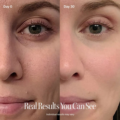 Revella™ 4‑in‑1 Red Light Therapy Wand + Activating Serum (Anti‑Aging, Skin Tightening, Collagen Boosting)