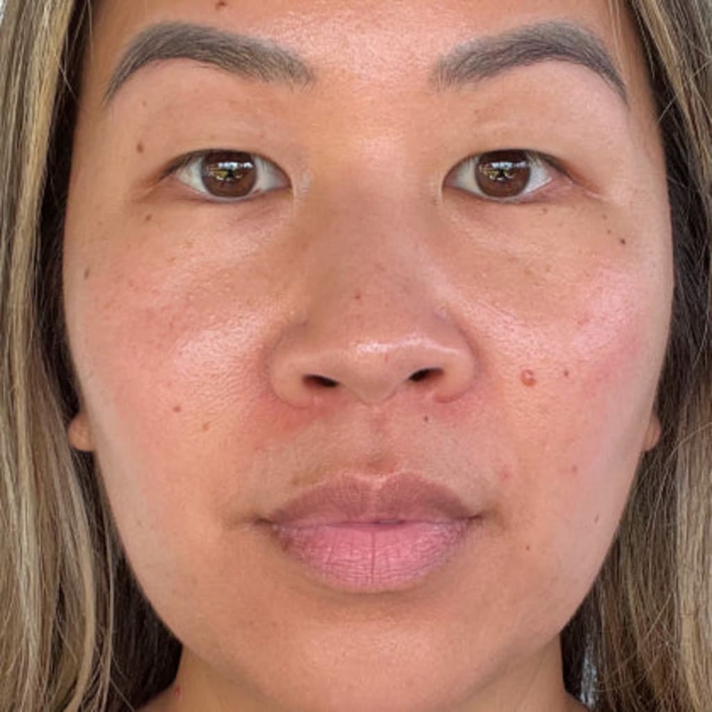 Revella™ 4‑in‑1 Red Light Therapy Wand + Activating Serum (Anti‑Aging, Skin Tightening, Collagen Boosting)