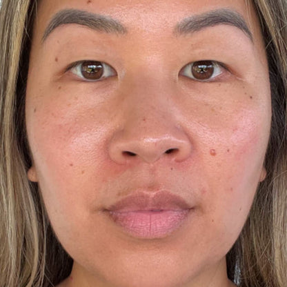Revella™ 4‑in‑1 Red Light Therapy Wand + Activating Serum (Anti‑Aging, Skin Tightening, Collagen Boosting)