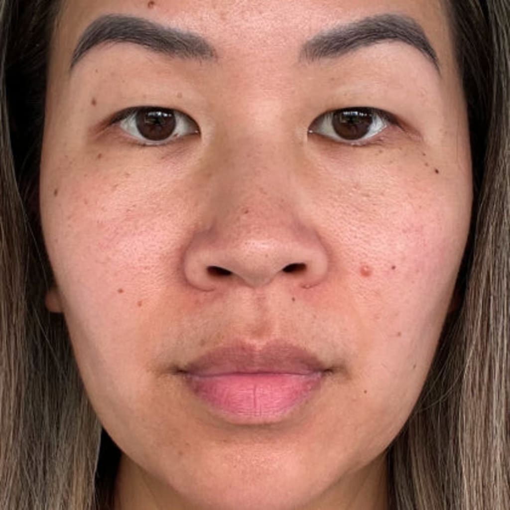 Revella™ 4‑in‑1 Red Light Therapy Wand + Activating Serum (Anti‑Aging, Skin Tightening, Collagen Boosting)