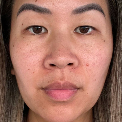 Revella™ 4‑in‑1 Red Light Therapy Wand + Activating Serum (Anti‑Aging, Skin Tightening, Collagen Boosting)