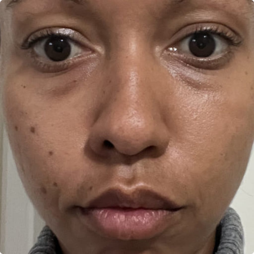 Revella™ 4‑in‑1 Red Light Therapy Wand + Activating Serum (Anti‑Aging, Skin Tightening, Collagen Boosting)