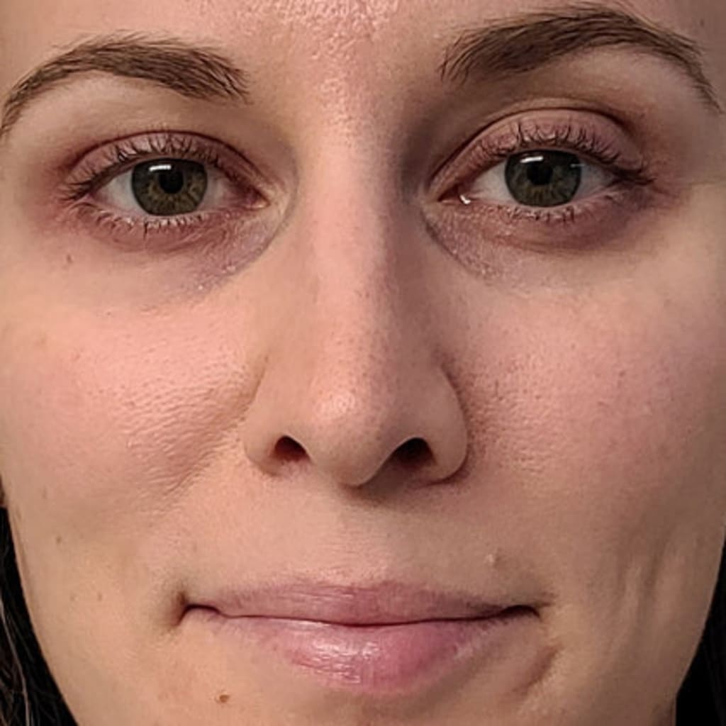 Revella™ 4‑in‑1 Red Light Therapy Wand + Activating Serum (Anti‑Aging, Skin Tightening, Collagen Boosting)