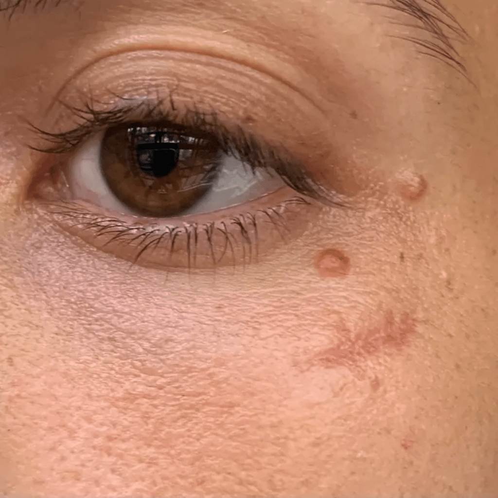 Revella™ 4‑in‑1 Red Light Therapy Wand + Activating Serum (Anti‑Aging, Skin Tightening, Collagen Boosting)