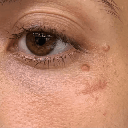 Revella™ 4‑in‑1 Red Light Therapy Wand + Activating Serum (Anti‑Aging, Skin Tightening, Collagen Boosting)