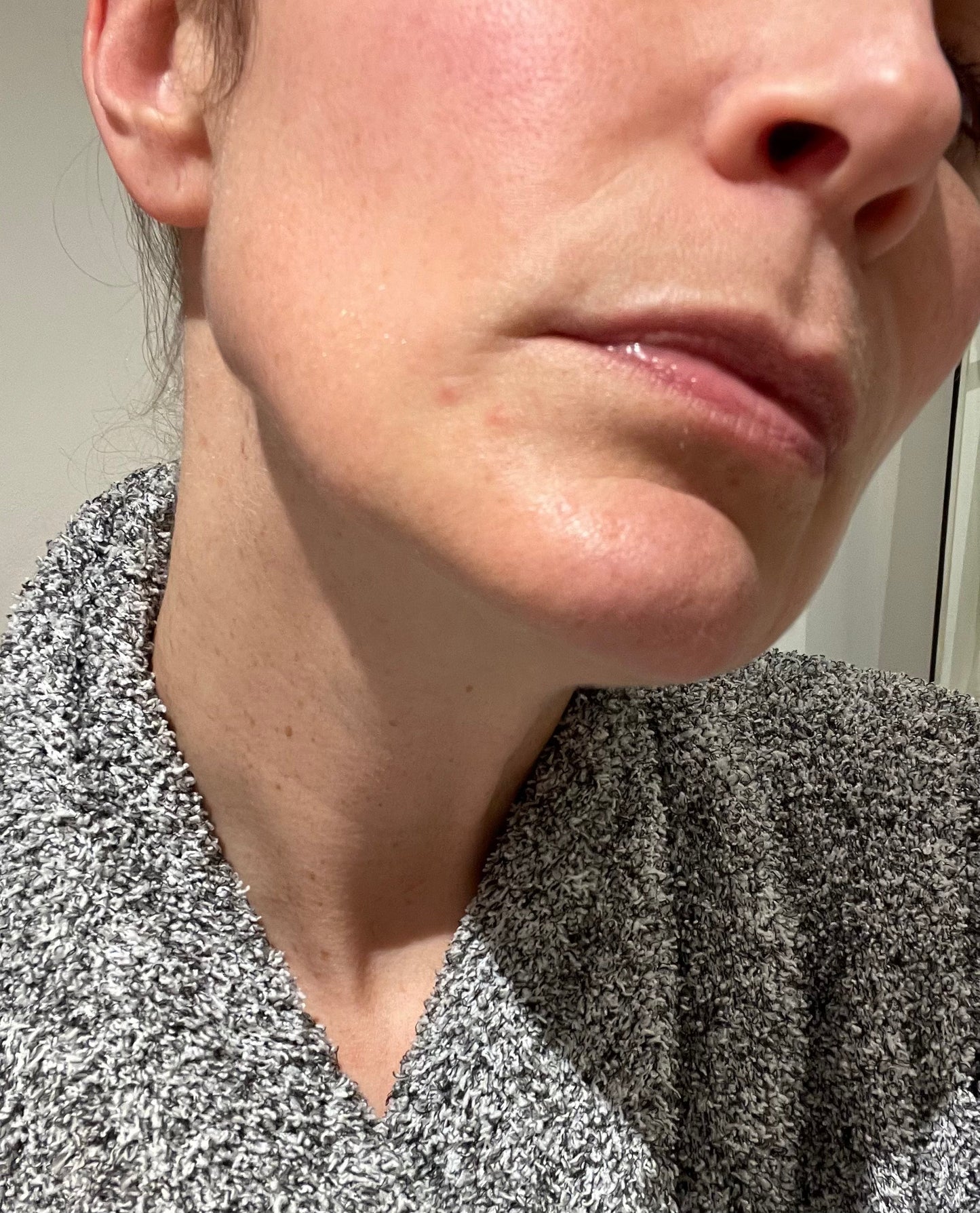 Revella™ 4‑in‑1 Red Light Therapy Wand + Activating Serum (Anti‑Aging, Skin Tightening, Collagen Boosting)