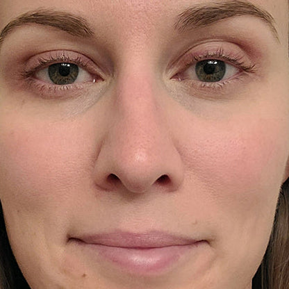 Red Light Therapy Wand