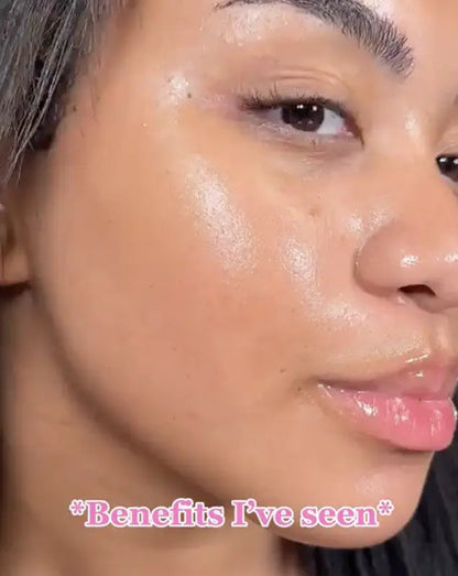 Revella™ 4‑in‑1 Red Light Therapy Wand + Activating Serum (Anti‑Aging, Skin Tightening, Collagen Boosting)